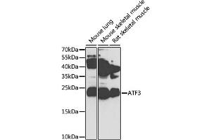 Western blot analysis of extracts of various cell lines, using  antibody (ABIN3023657, ABIN3023658, ABIN3023659, ABIN1678765 and ABIN6218982) at 1:1000 dilution. (ATF3 antibody  (AA 1-181))