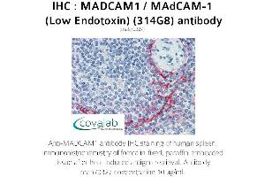 Image no. 1 for anti-Mucosal Vascular Addressin Cell Adhesion Molecule 1 (MADCAM1) antibody (ABIN5693628) (MADCAM1 antibody)