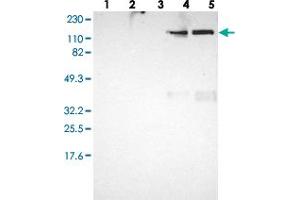 Western blot analysis of Lane 1: RT-4, Lane 2: U-251 MG, Lane 3: Human Plasma, Lane 4: Liver, Lane 5: Tonsil with ITIH4 polyclonal antibody . (ITIH4 antibody)