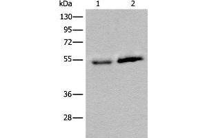 Western blot analysis of Human fetal intestines tissue and Human breast cancer tissue lysates using CCDC85C Polyclonal Antibody at dilution of 1:400 (CCDC85C antibody)