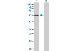 Western Blot analysis of CCNE1 expression in transfected 293T cell line by CCNE1 MaxPab polyclonal antibody. (Cyclin E1 antibody  (AA 1-410))