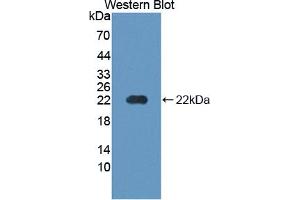 Figure. (PTH1R antibody  (AA 28-188))