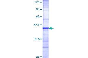 Nibrin Protein (NBN) (AA 645-754) (GST tag)