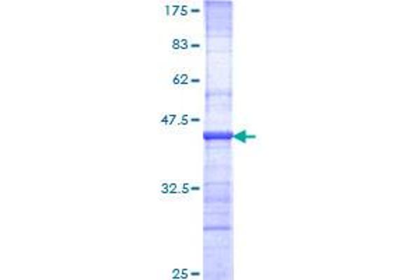 Nibrin Protein (NBN) (AA 645-754) (GST tag)
