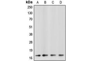 Western blot analysis of Caspase 3 p17 expression in SP2/0 (A), Jurkat etoposide-treated (B), NIH3T3 staurosporine-treated (C), HeLa (D) whole cell lysates. (Caspase 3 p17 (Center) antibody)