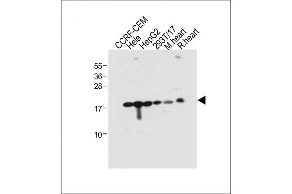 RPL23A anticorps  (C-Term)