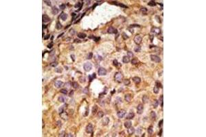 Image no. 3 for anti-Toll-Like Receptor 6 (TLR6) (C-Term) antibody (ABIN357055) (TLR6 antibody  (C-Term))