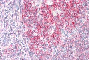 ABIN184723 (5µg/ml) staining of paraffin embedded Human Tonsil. (SWAP70 antibody  (C-Term))