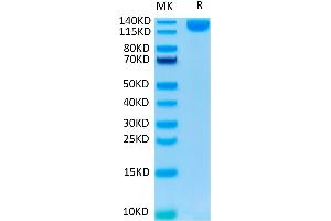 SARS-COV-2 Spike S1 on Tris-Bis PAGE under reduced condition. (SARS-CoV-2 Spike S1 Protein (Fc-Avi Tag))
