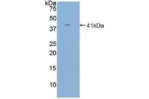 Detection of Recombinant BAFFR, Human using Polyclonal Antibody to B-Cell Activation Factor Receptor (BAFFR) (BAFF antibody  (AA 96-184))