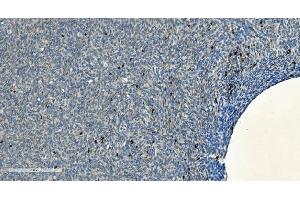 IHC analysis of CD20/MS4A1 using anti-CD20/MS4A1 antibody (ABIN7599233).