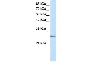 C20ORF20 antibody used at 2. (MRGBP antibody  (N-Term))