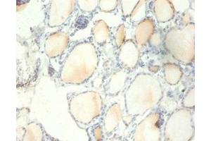Immunohistochemistry of paraffin-embedded human thyroid tissue using ABIN7142488 at dilution of 1:100 (RPS13 antibody  (AA 3-151))