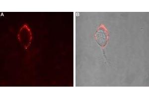 Expression of GABA(A) α4 Receptor in rat PC12 cells - Cell surface detection of GABA(A) α4 Receptor in intact living rat pheochromocytoma PC12 cells. (GABRA4 antibody  (Extracellular, N-Term))