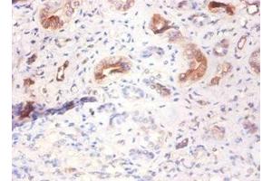 Immunohistochemistry of paraffin-embedded human kidney tissue using ABIN7143786 at dilution of 1:100 (Fetuin A antibody  (AA 20-296))