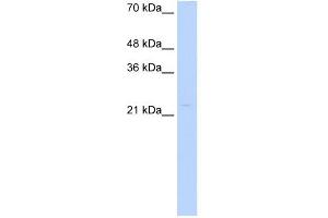 WB Suggested Anti-CDX4 Antibody Titration: 0. (CDX4 antibody  (Middle Region))