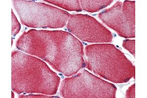 Anti-HSPB7 / CvHSP antibody IHC of human skeletal muscle.