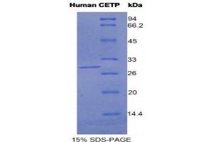 SDS-PAGE (SDS) image for Cholesteryl Ester Transfer Protein (CETP) (AA 81-311) protein (His tag) (ABIN1525385)