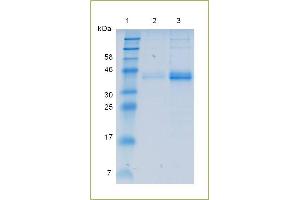 SDS-PAGE analysis of recombinant IL12 p40. (IL12B Protein (AA 23-328) (His tag))