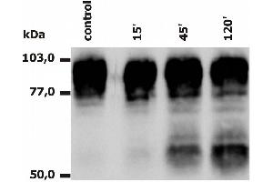 Western Blotting analysis of PMA-activated neutrophils (Fig. (Integrin beta 2 antibody)