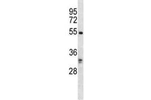 RIPK3 antibody western blot analysis in K562 lysate. (RIPK3 antibody  (AA 480-509))