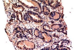 Immunohistochemistry of paraffin-embedded Human prostate tissue using CASP3 Monoclonal Antibody at dilution of 1:200. (Caspase 3 antibody)