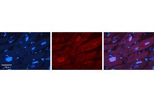Rabbit Anti-ERF Antibody   Formalin Fixed Paraffin Embedded Tissue: Human heart Tissue Observed Staining: Nucleus Primary Antibody Concentration: 1:100 Other Working Concentrations: 1:600 Secondary Antibody: Donkey anti-Rabbit-Cy3 Secondary Antibody Concentration: 1:200 Magnification: 20X Exposure Time: 0. (ERF antibody  (N-Term))