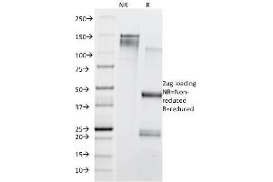 SDS-PAGE Analysis Purified CD71 Mouse Monoclonal Antibody (TFRC/1839).
