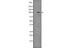 Western blot analysis of PMEL17 / GP100 using 293 whole cell lysates (Melanoma gp100 antibody  (C-Term))