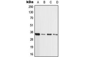 Western blot analysis of MLL4 expression in HL60 (A), A549 (B), NIH3T3 (C), H9C2 (D) whole cell lysates. (MLL4 antibody  (Center))