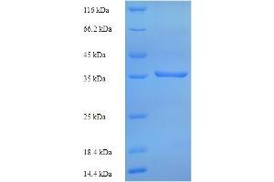 SDS-PAGE (SDS) image for Ribosomal Protein, Large, P0 (RPLP0) (AA 1-317), (full length) protein (His tag) (ABIN5713800) (RPLP0 Protein (AA 1-317, full length) (His tag))