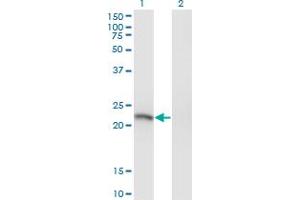 SSX3 antibody  (AA 1-100)