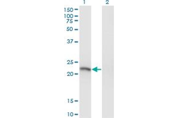 SSX3 antibody  (AA 1-100)