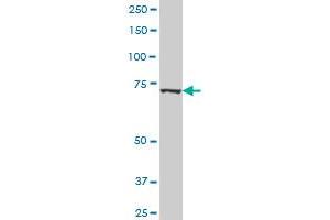 NCSTN polyclonal antibody (A01), Lot # 051214JC01 Western Blot analysis of NCSTN expression in Hela S3 NE . (Nicastrin antibody  (AA 16-115))