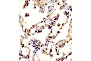 Antibody staining MMP12 in human lung tissue sections by Immunohistochemistry (IHC-P - paraformaldehyde-fixed, paraffin-embedded sections). (MMP12 antibody  (C-Term))