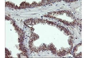 Image no. 4 for anti-Retinaldehyde Binding Protein 1 (RLBP1) antibody (ABIN1497622) (RLBP1 antibody)