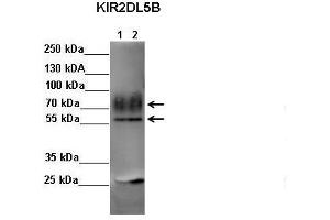 Sample Type: Lane 1: FALG IP'd FLAG-KIR2DL4 transfected NK92 cells Lane 2: FALG IP'd FLAG-KIR2DL5 transfected NK92 cells Primary Antibody Dilution: 1:500Secondary Antibody: Anti-rabbit-HRP Secondary Antibody Dilution: 1:00,000 Color/Signal Descriptions: KIR2DL5B  Gene Name: Kerry S. (KIR2DL5B antibody  (C-Term))