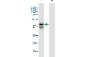 Western Blot analysis of LDHAL6B expression in transfected 293T cell line by LDHAL6B monoclonal antibody (M01), clone 1A3. (LDHAL6B antibody  (AA 282-381))