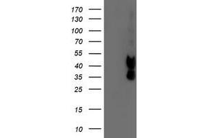Western Blotting (WB) image for anti-Prenyl (Decaprenyl) Diphosphate Synthase, Subunit 2 (PDSS2) antibody (ABIN1500141)