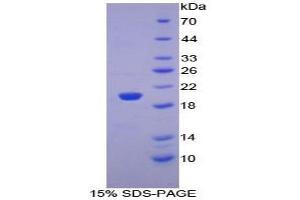 SDS-PAGE analysis of Mouse PHLDA2 Protein.
