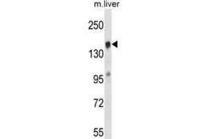 Western Blotting (WB) image for anti-T-Cell Lymphoma Invasion and Metastasis 2 (TIAM2) antibody (ABIN2997432) (TIAM2 antibody)