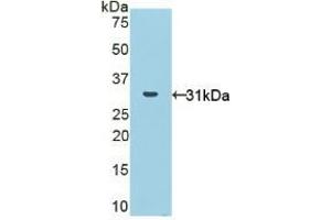 Detection of Recombinant NOX1, Human using Polyclonal Antibody to Nicotinamide Adenine Dinucleotide Phosphate Oxidase 1 (NOX1) (NOX1 antibody  (AA 235-488))