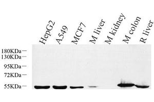 Western Blot analysis of various samples using CK-8 Polyclonal Antibody at dilution of 1:1000. (KRT8 antibody)