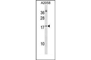 Western blot analysis of HEN2 Antibody (Center) in A2058 cell line lysates (35ug/lane). (NHLH2 antibody  (Middle Region))