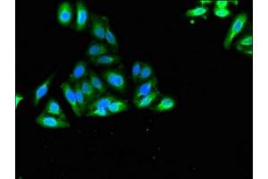 Immunofluorescent analysis of HepG2 cells using ABIN7175662 at dilution of 1:100 and Alexa Fluor 488-congugated AffiniPure Goat Anti-Rabbit IgG(H+L) (SORCS2 antibody  (AA 712-786))