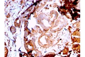 Immunohistochemistry (IHC) image for anti-Heat Shock Protein 90kDa beta (Grp94), Member 1 (HSP90B1) antibody (ABIN6940801)