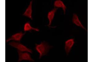 ABIN6267550 staining HepG2 by IF/ICC. (BMX antibody  (pTyr566))