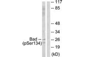 Western blot analysis of extracts from mouse liver, using BAD (Phospho-Ser134) Antibody. (BAD antibody  (pSer134))