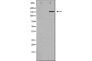 Western blot analysis of DNA Polymerase α expression in 293 cells,The lane on the left is treated with the antigen-specific peptide. (POLA1 antibody  (N-Term))