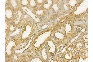 ABIN6264846 and ABIN6273312 at 1/100 staining human normal kidney tissue by IHC-P.
